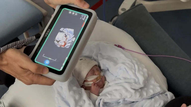 EINSTAR VEGA 3D Scanner scanning infant's face